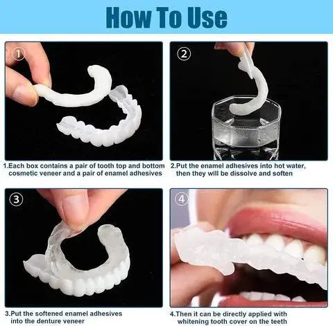 Adjustable Snap-On Dentures Pameza