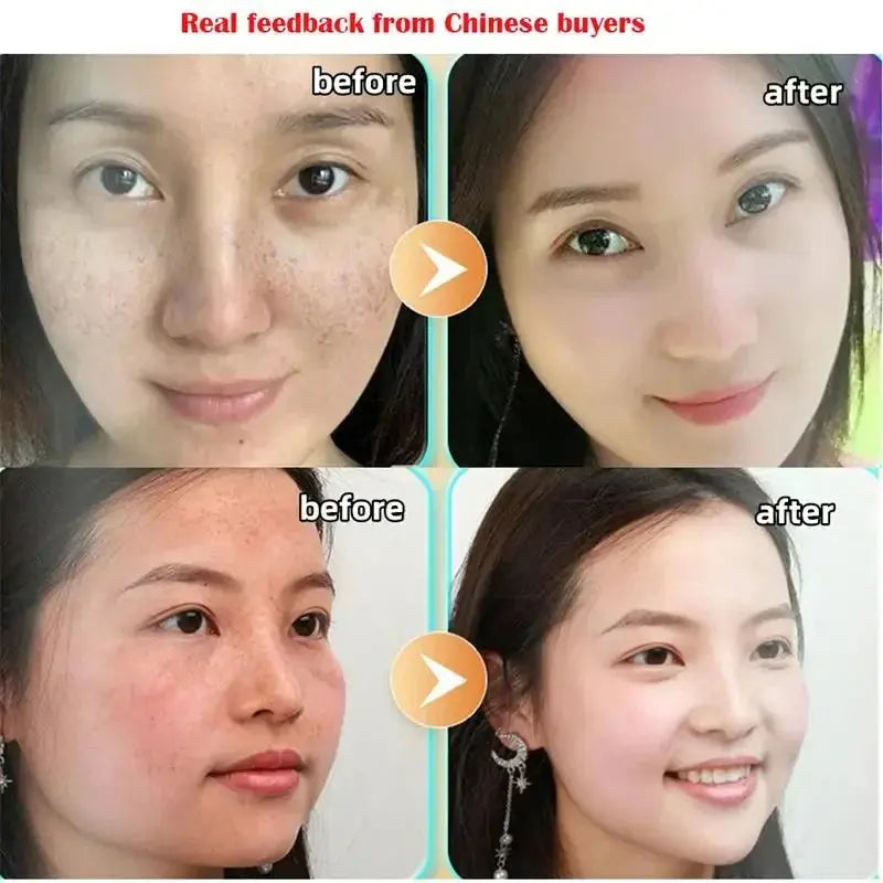 Dark Spot Corrector Skin Whitening Cream Pameza