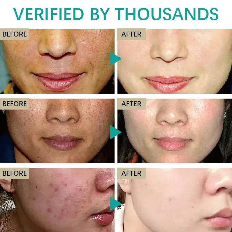 Dark Spot Corrector Skin Whitening Cream Pameza