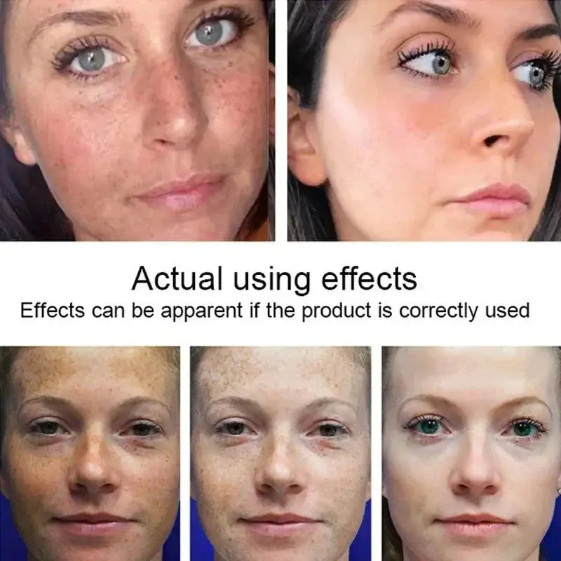 Dark Spot Corrector Skin Whitening Cream Pameza
