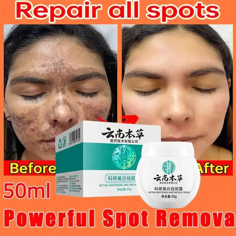 Dark Spot Corrector Skin Whitening Cream Pameza