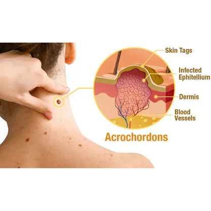 AQA™ TagRecede Bee Venom Treatment Spray Pameza