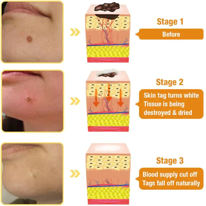 AQA™ TagRecede Bee Venom Treatment Spray Pameza