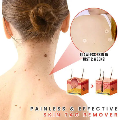 Blusoms™ MicroDarts TAG'Gone Patch Pameza