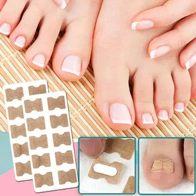 Correction patches for beautiful and healthy nails Pameza