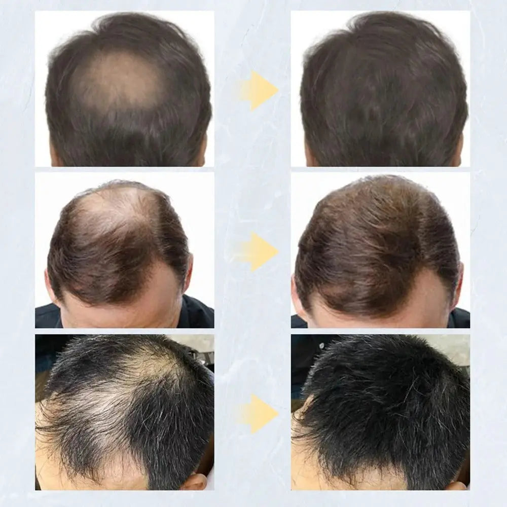 Hair Fibers Keratin Thickening Pameza