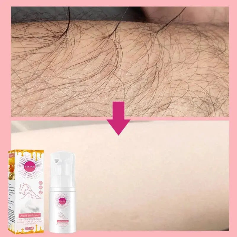 Hair Removal Spray Pameza