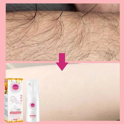 Hair Removal Spray Pameza