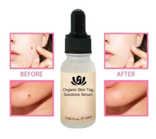 NATURAL SPOTS FREE SERUM Pameza