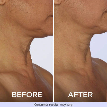 Neck Tightening Cream - Pameza