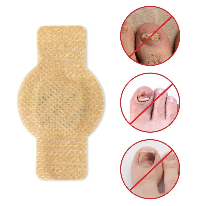 Fungal Nail Patches (21 Pcs)
