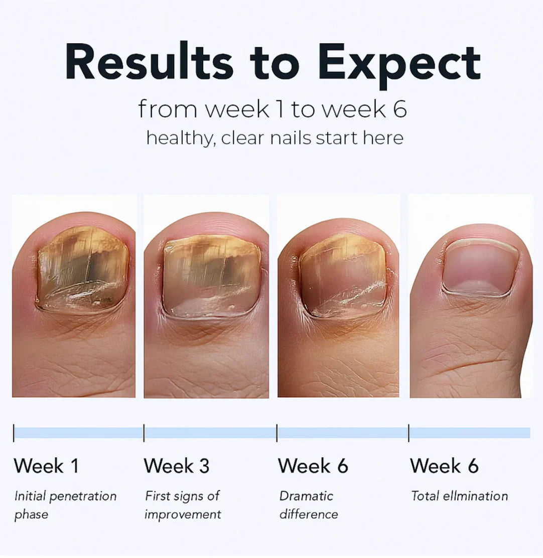 Fungal Nail Patches (21 Pcs)