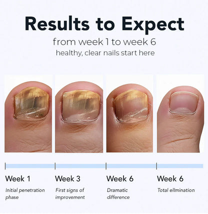 Fungal Nail Patches (21 Pcs)