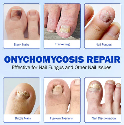 Fungal Nail Patches (21 Pcs)
